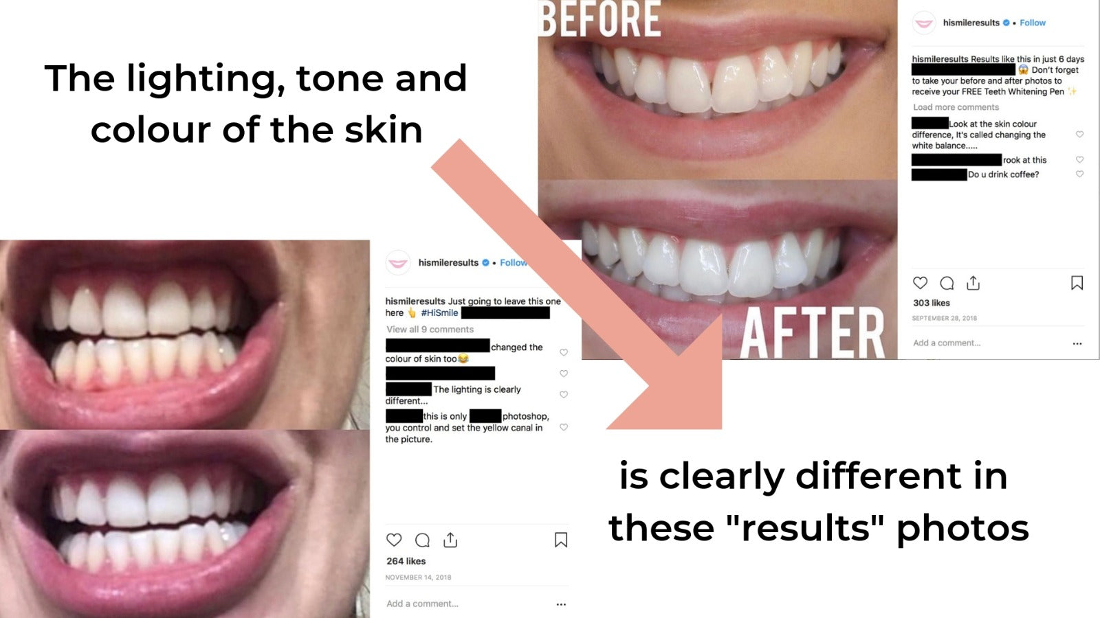 Hismile Tooth Cleansing Purple